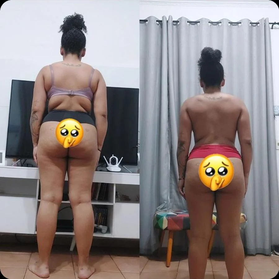 Antes e depois Vanessa