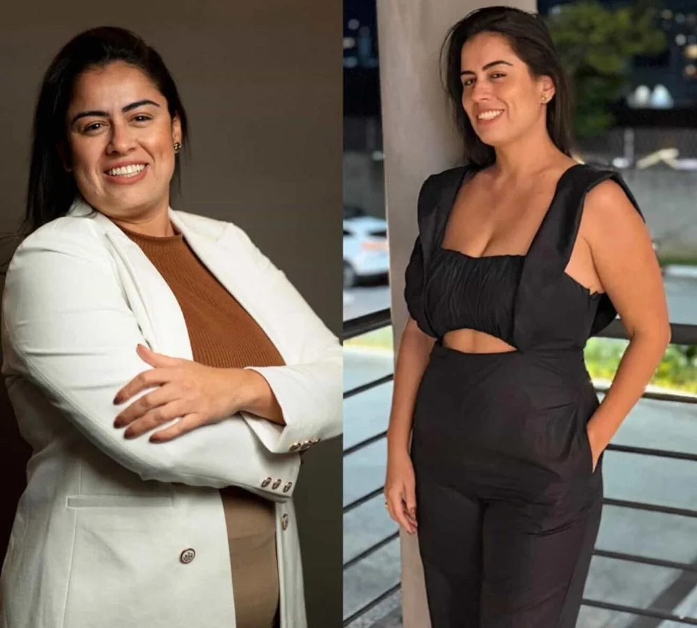 Antes e depois Camila